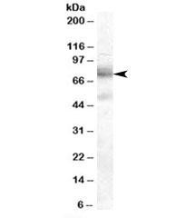 Anti-DCP1A