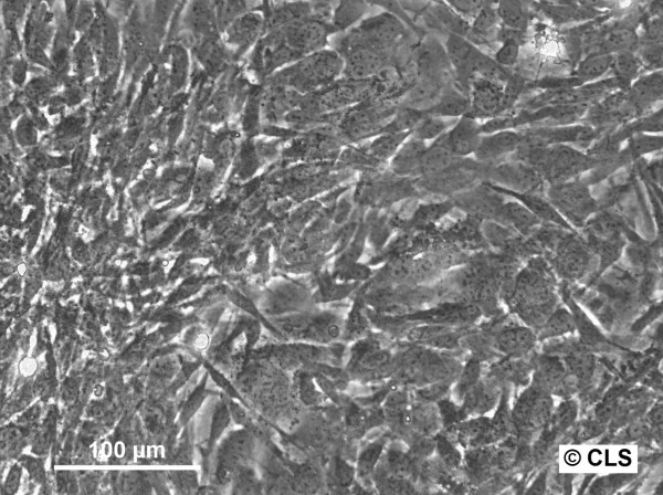 OCD Cells