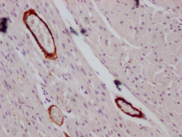 Anti-ACTA2/ACTG2 Monoclonal