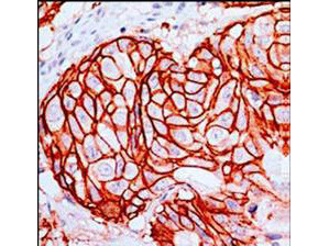 Anti-c-erbB2, clone SP3