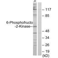 Anti-PFKFB2