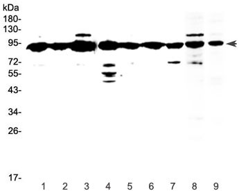 Anti-XRCC1