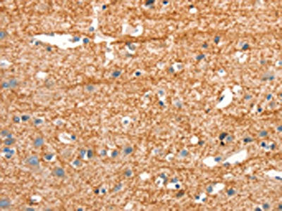 Anti-ARHGEF11