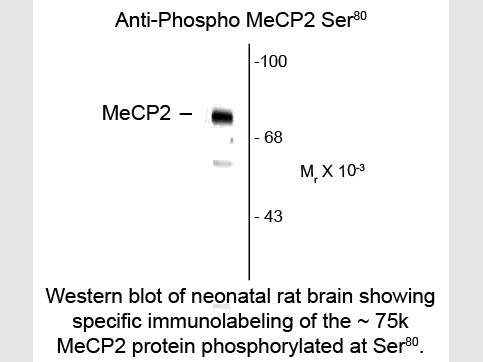 Anti-phospho-MeCP2 (Ser80)