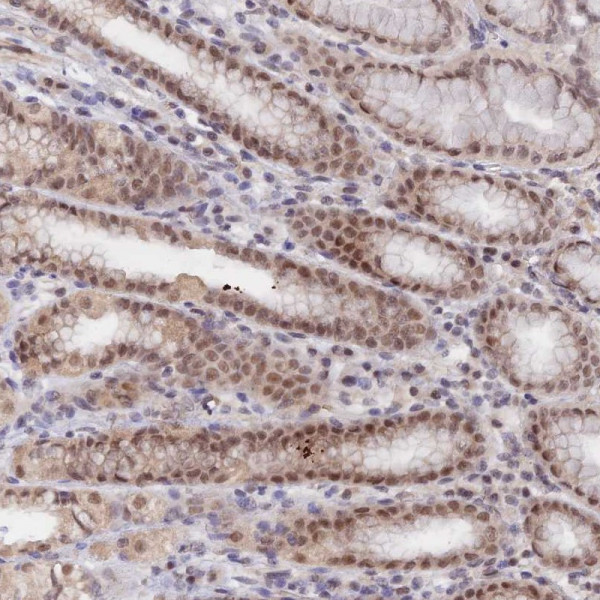 Anti-ANAPC4