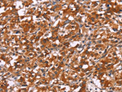 Anti-HSPB6