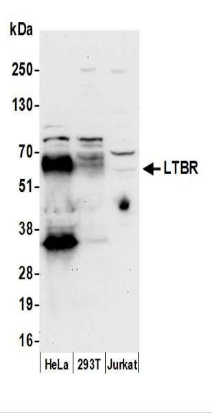 Anti-LTBR/Lymphotoxin-beta Receptor