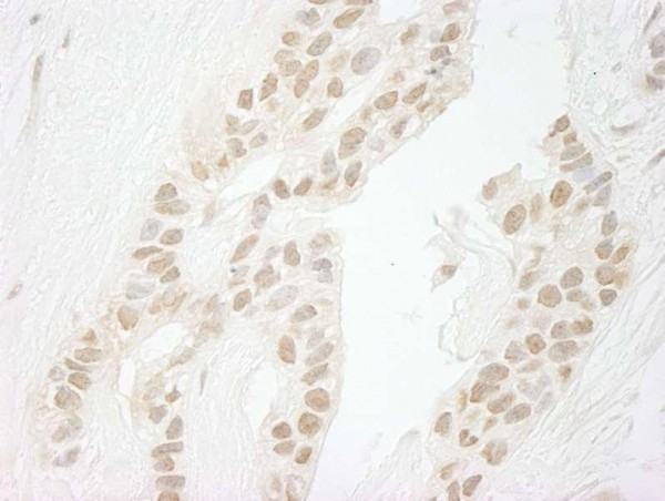 Anti-PPP1CC (IHC)