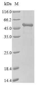 Pyruvate dehydrogenase E1 component subunit alpha, somatic form, mitochondrial (PDHA1),partial, huma