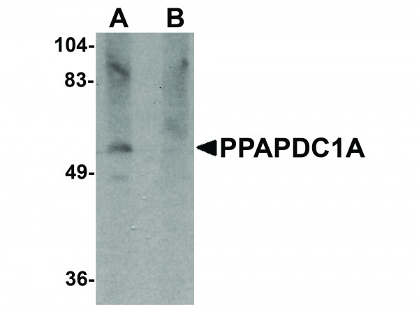 Anti-PPAPDC1A