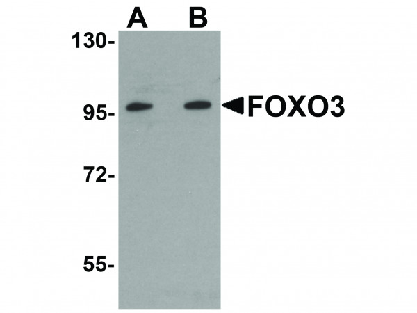 Anti-FOXO3