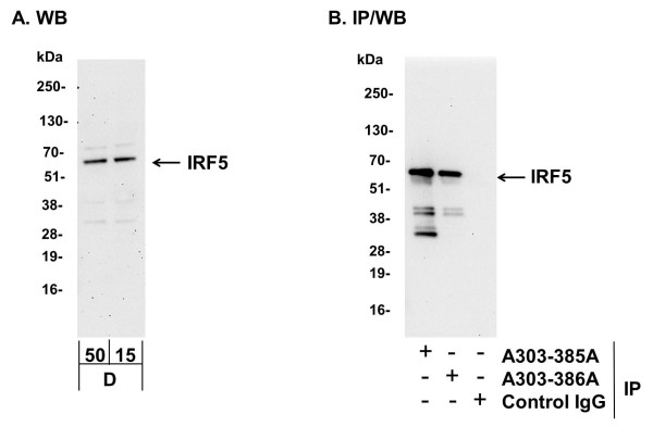 Anti-IRF5