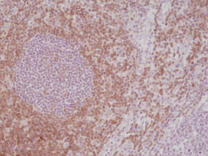 Anti-CD5 (human), Rabbit Monoclonal (RM354)