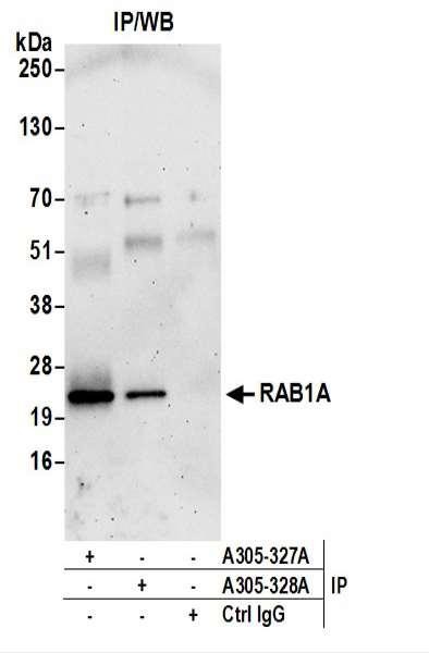 Anti-RAB1A