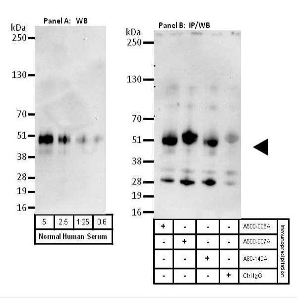 Anti-Beta-2-Glycoprotein 1 Monoclonal
