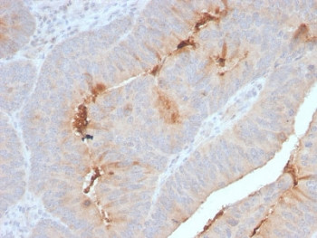 Anti-Serum Amyloid A / SAA1 + SAA2, clone SAA/2868R