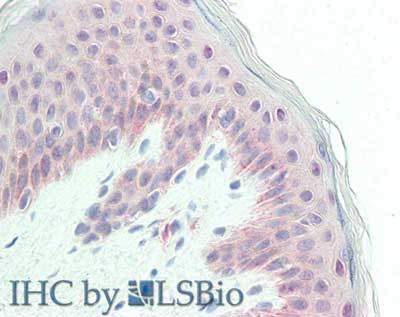 Anti-Glypican-1