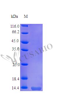 Tumor necrosis factor receptor superfamily member 10B (TNFRSF10B), partial (Active), human, recombin