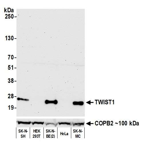 Anti-TWIST Recombinant Monoclonal