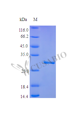 Plasminogen protein (PLG), partial (Active), human, recombinant