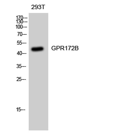 Anti-GPR172B