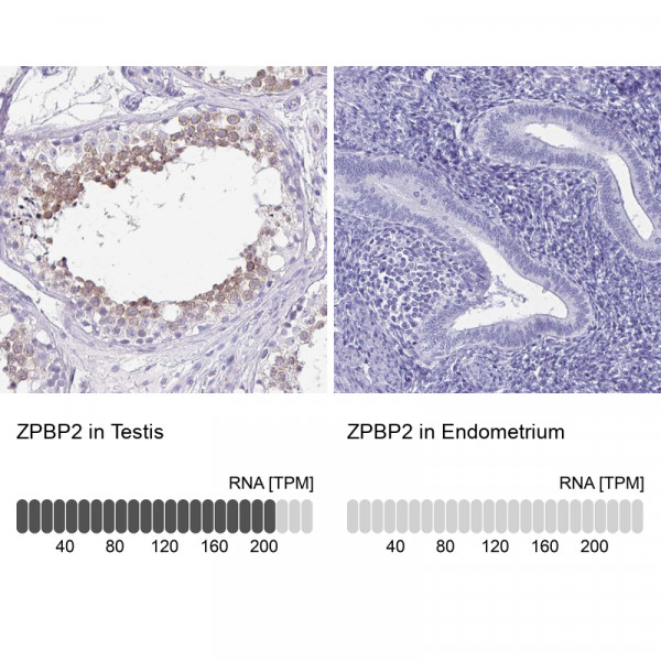 Anti-ZPBP2