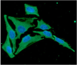 Anti-CNDP2, clone 15E5