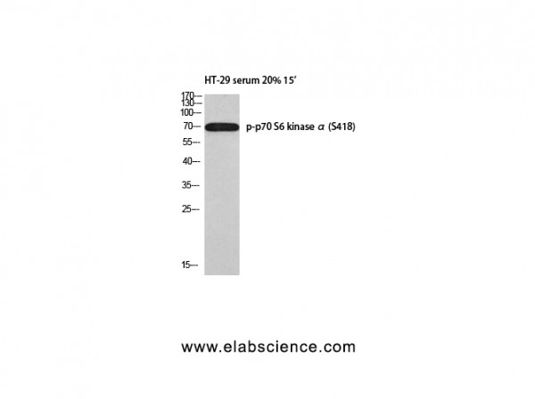 Anti-Phospho-p70 S6 kinase alpha (Ser418)