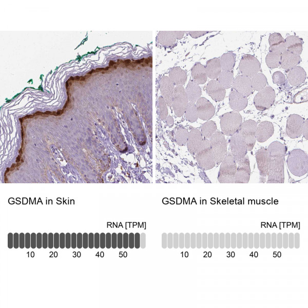 Anti-GSDMA