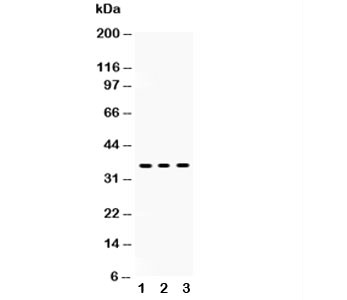 Anti-SIRT6