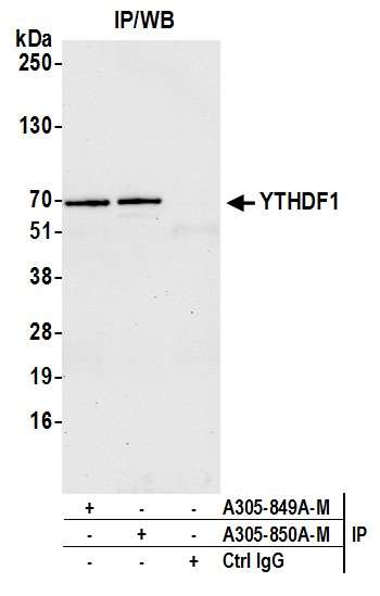Anti-YTHDF1