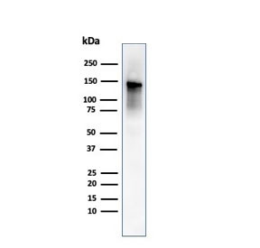 Anti-Caldesmon / CAD HMW, clone SPM168
