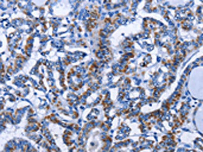 Anti-MMP16