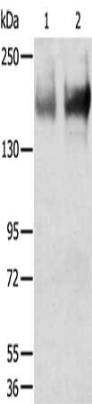 Anti-TRPM6