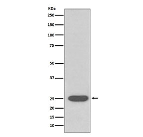 Anti-Superoxide Dismutase 2 / SOD2, clone IDO-19