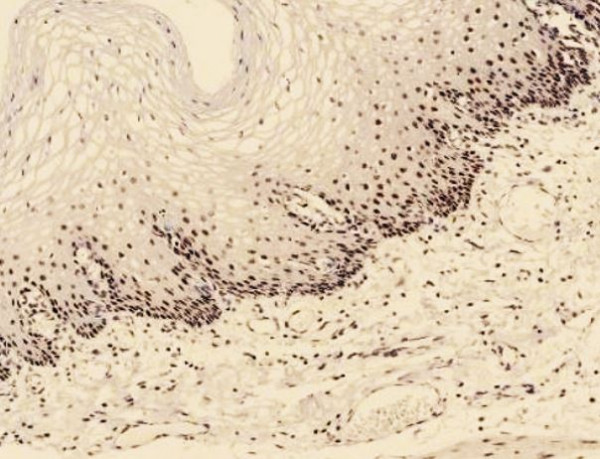 Anti-PMS2, clone SQab20195