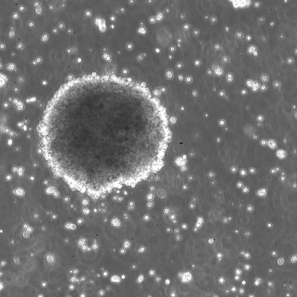 B-LCL-HROG04 Cells