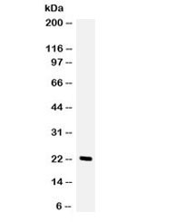Anti-Granulocyte-Colony Stimulating Factor / CSF3