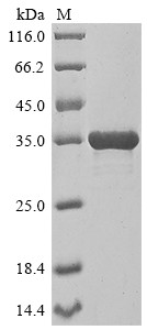 Dolichyl-phosphate-mannose--protein mannosyltransferase 2 (PMT2), partial, Saccharomyces cerevisiae,