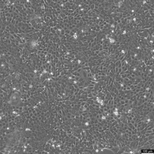 Capan-1 Cells