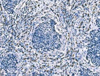 Anti-CD101