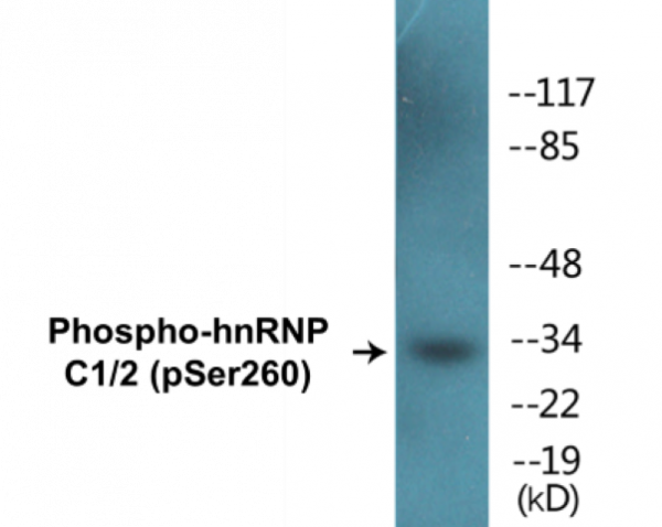 hnRNP C1/2 (Phospho-Ser260) Colorimetric Cell-Based ELISA Kit