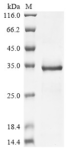 Glycine cleavage system H protein, mitochondrial (GCSH), chicken, recombinant