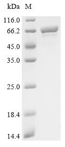 Chaperonin GroEL (groEL), partial, recombinant Stenotrophomonas maltophilia