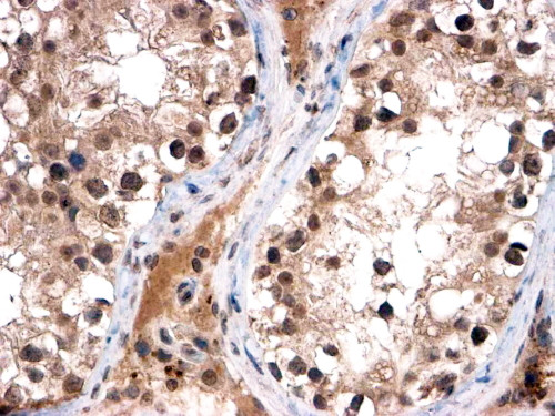Anti-FOXI1, C-terminal