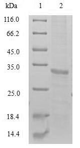 Testisin (PRSS21), human, recombinant