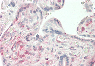 Anti-ANGPTL4 (coiled-coil domain) (human), clone Kairos4-397G