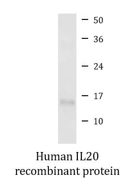 Human IL20 recombinant protein (Active)