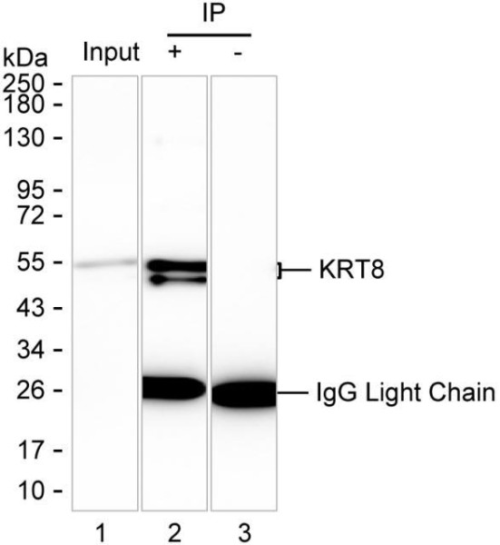 Anti-KRT8