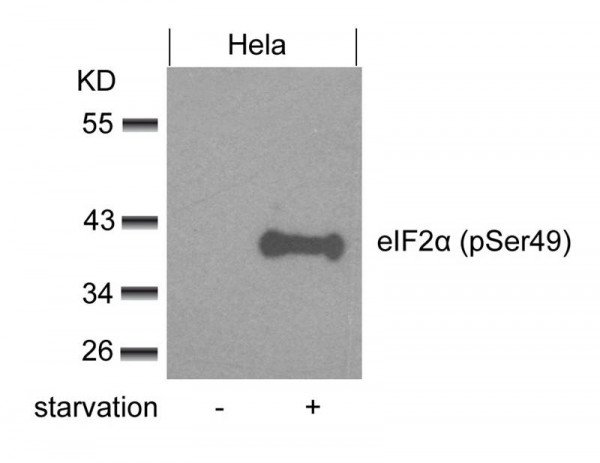 Anti-phospho-eIF2 alpha (Ser49)